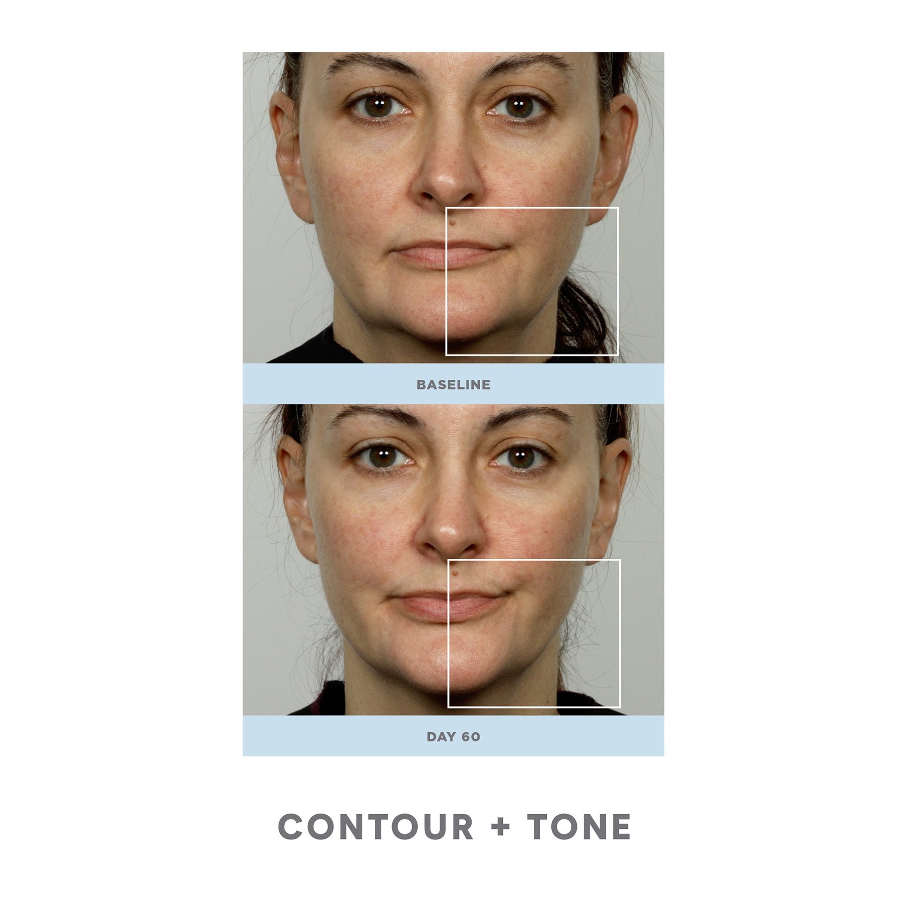 NuFace Trinity Pro